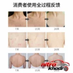نمای کناری اسپری ضد جوش بدن رایکو با عصاره سنتلا آسیتیکا عمق قاب و پروفایل
