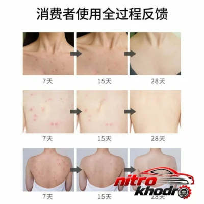 نمای کناری اسپری ضد جوش بدن رایکو با عصاره سنتلا آسیتیکا عمق قاب و پروفایل