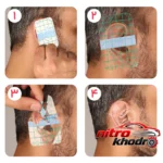 نمای جزئیات محافظ گوش نوزاد Tiny Shield با چسب شفاف و نازک حرکت و نصب پشتی